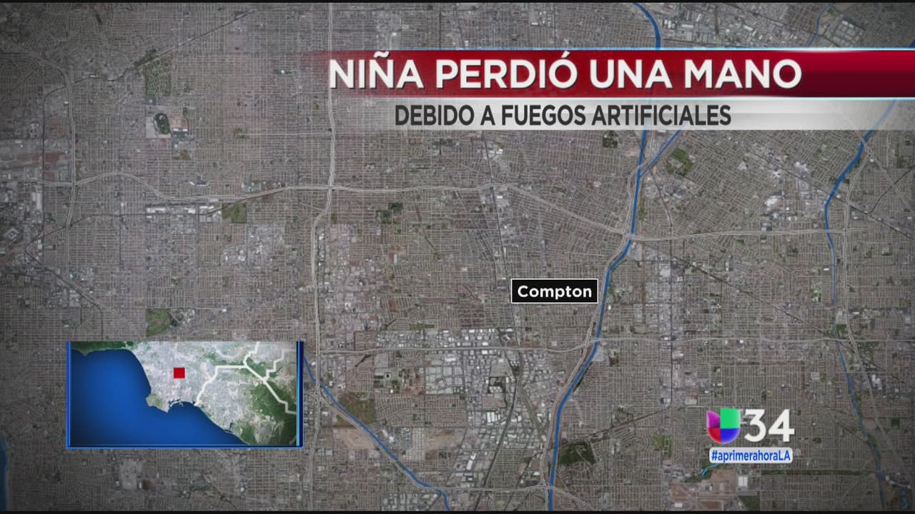 Niña de 9 años pierde una mano por explosión de pirotecnia ilegal en Compton