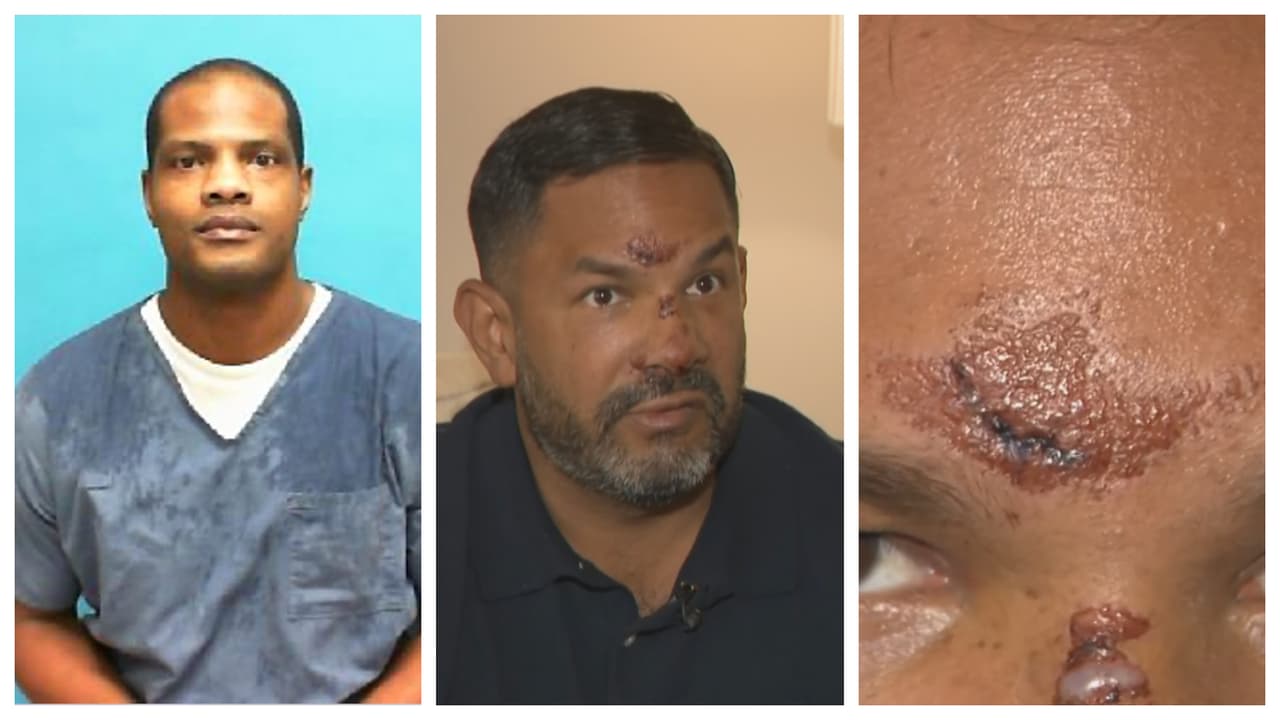 Policía de Fort Lauderdale arresta a exconvicto que habría atacado a un hombre por ser gay