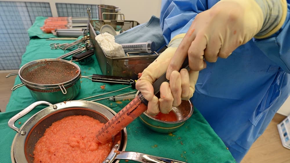 Sentencian a una falsa doctora en California que inyectaba "grasa de cordero" para aumento de glúteos