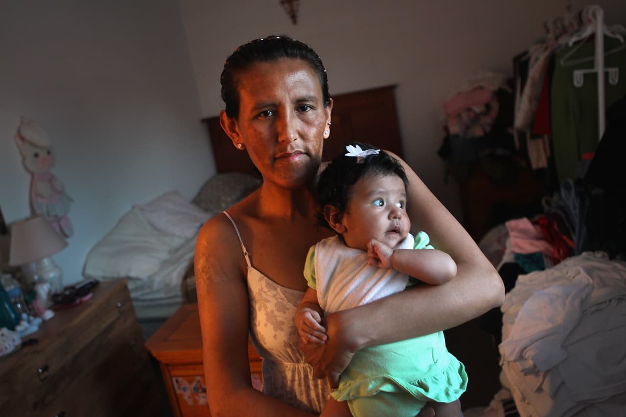 Jeanette Vizguerra, víctima de incidentes de odio