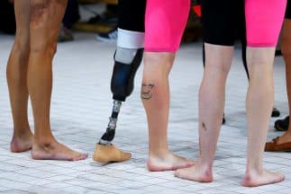 El tipo de discapacidad funcional más común es la limitación motora.