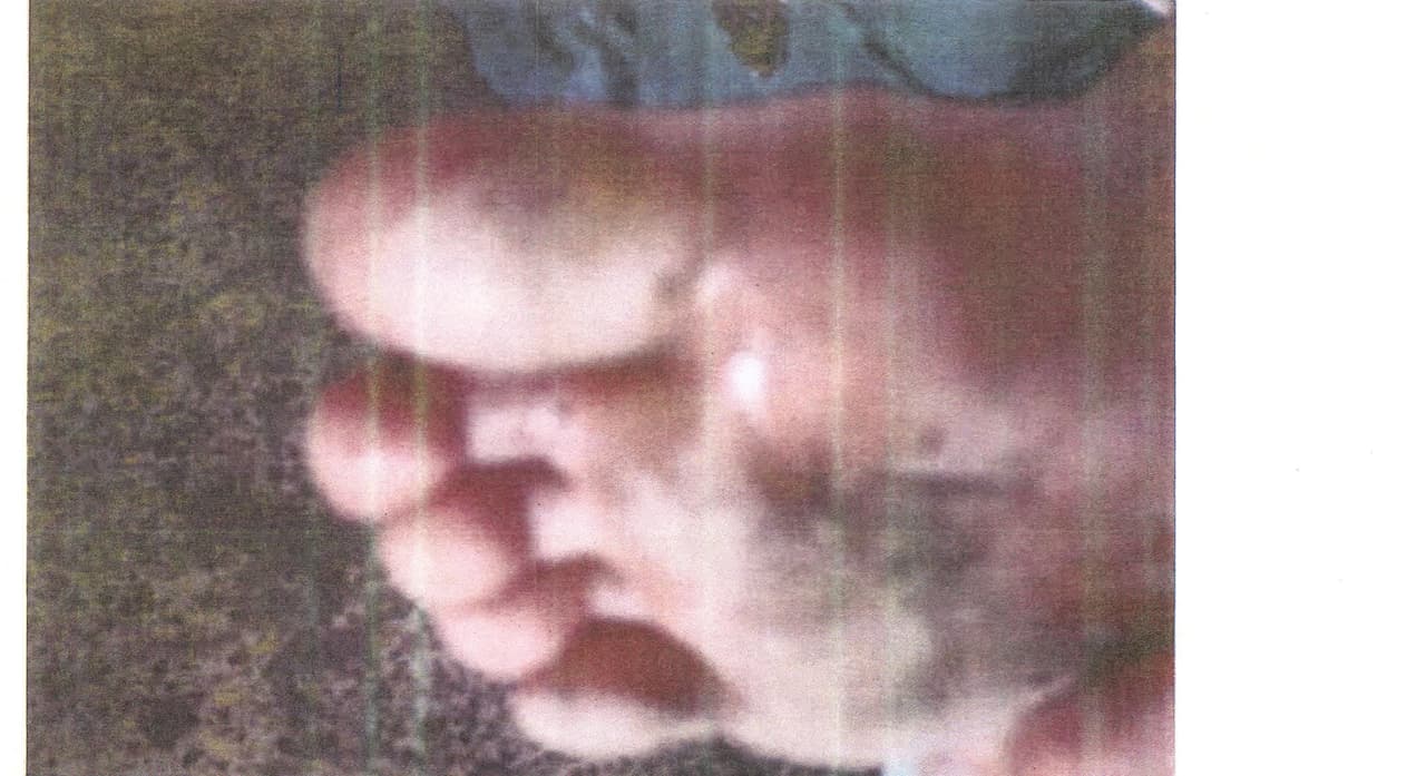 La imagen poco nítida de un pie lastimado.