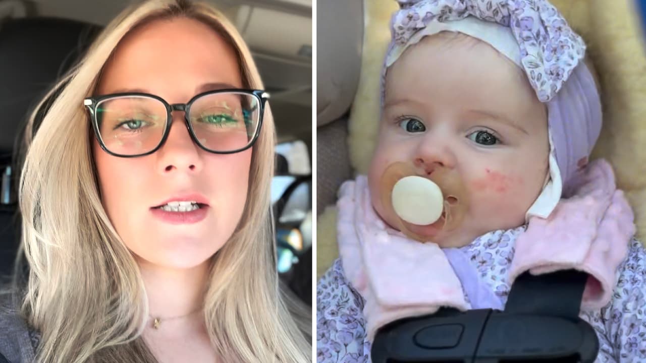 Muere bebé de 10 meses de conocida ‘influencer’ a causa de rara enfermedad en la piel