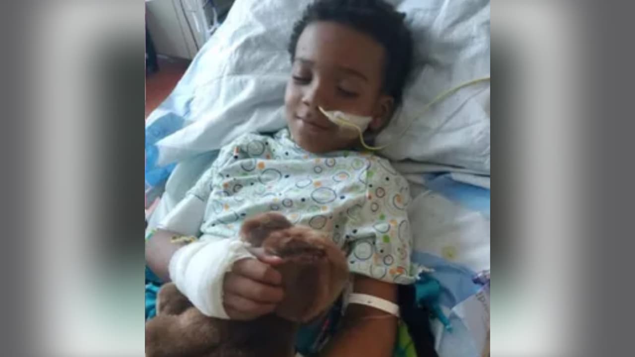Una madre creyó que su hijo de 7 años tenía gripe: el menor terminó con las piernas amputadas, daños en el corazón y en los riñones