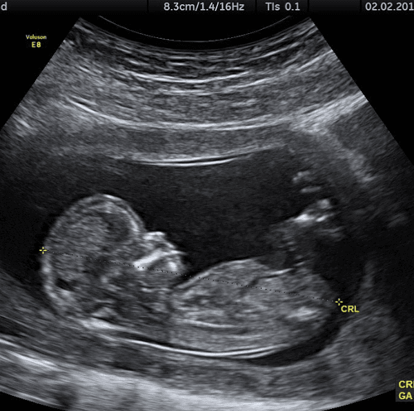 Bieber mostró a su esposa en plena revisión médica y también publicó una ecografía.