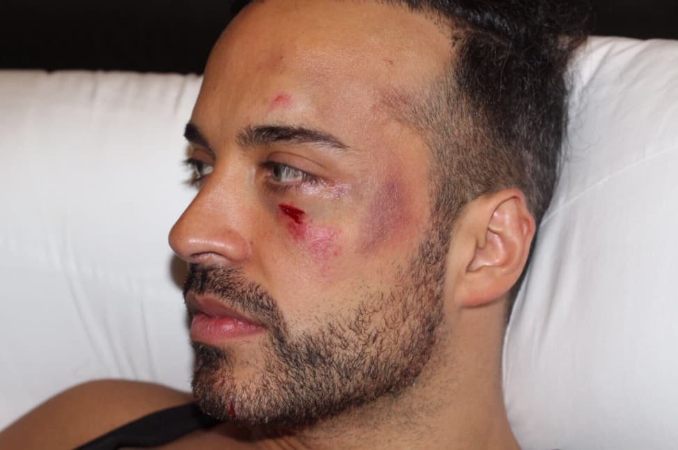 André Quijano
<b>fue atendido por un paramédico del hotel</b> Oasis Cancún, México, donde están hospedados.
<br>