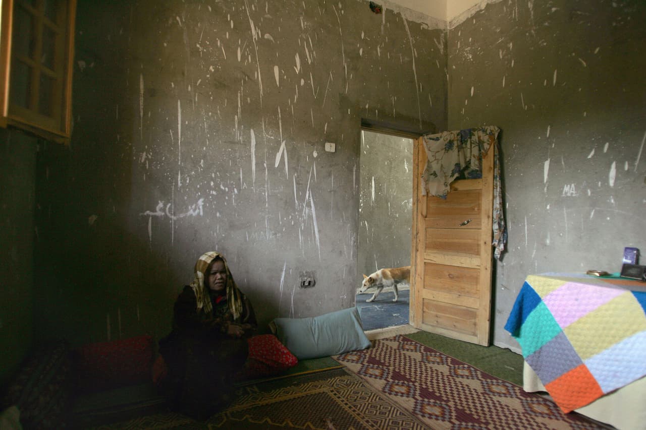 La lepra, que ha sido tan estigmatizada a lo largo de la historia por su notoria alteración de la piel, ya ha sido eliminada por casi todos los países de las Américas como problema de salud pública.