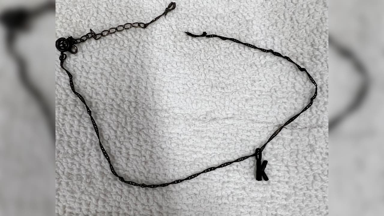 Las autoridades también encontraron un collar con un dije con la letra K. Se estima que la víctima mide 1.6" y su peso es deconocido.
<br>