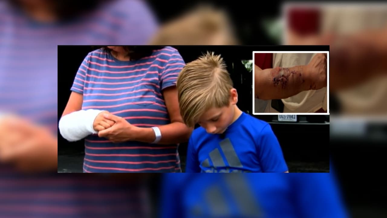 'Había un tiburón en mi brazo': Mujer de Pensilvania mordida por tiburón en Myrtle Beach