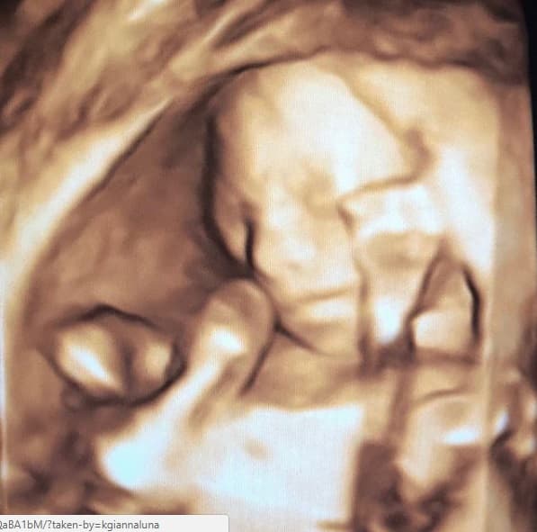 Este es el ultrasonido de 'Baby Moon' que hace unas semanas presumió Edwin Luna en sus redes sociales y es la imagen que aparece como foto de perfil en la cuenta de Instagram de Gianna: "La primera foto para mis papás".