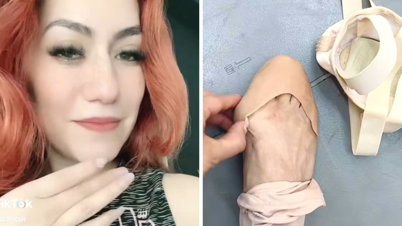  Bailarina de ballet muestra sus "pies feos" e impacta a TikTok con su extraño aspecto