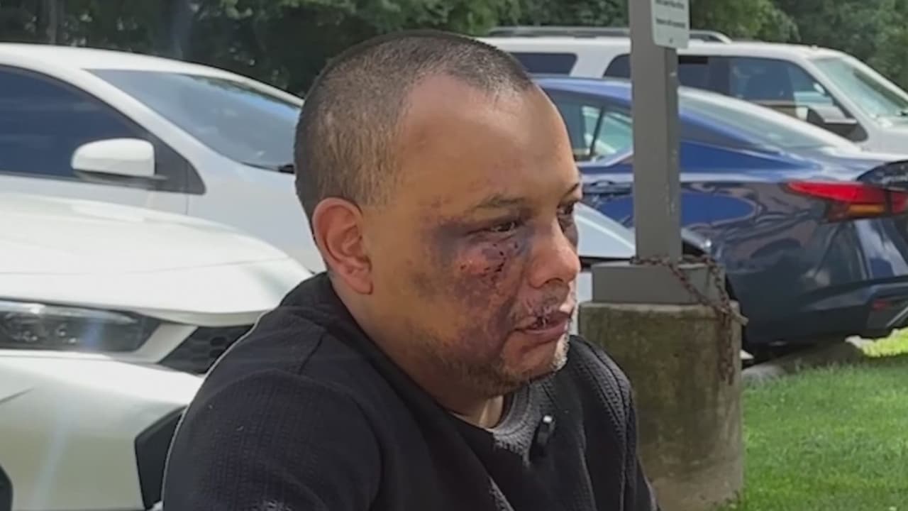 Niegan petición a mexicano agredido por ICE que busca atenderse en un médico
