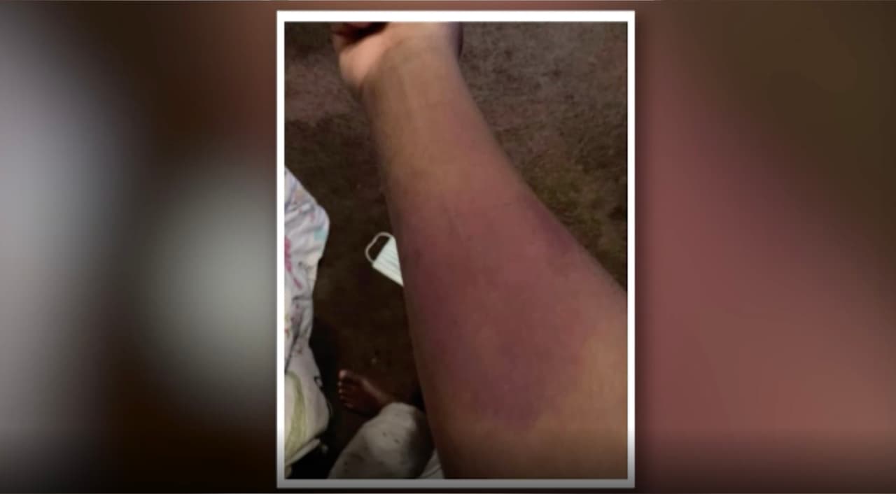 El incidente ocurrió después de que la menor estaba supuestamente corriendo dentro un salón de clases, la chica asegura que otros menores corrían, pero ella no.