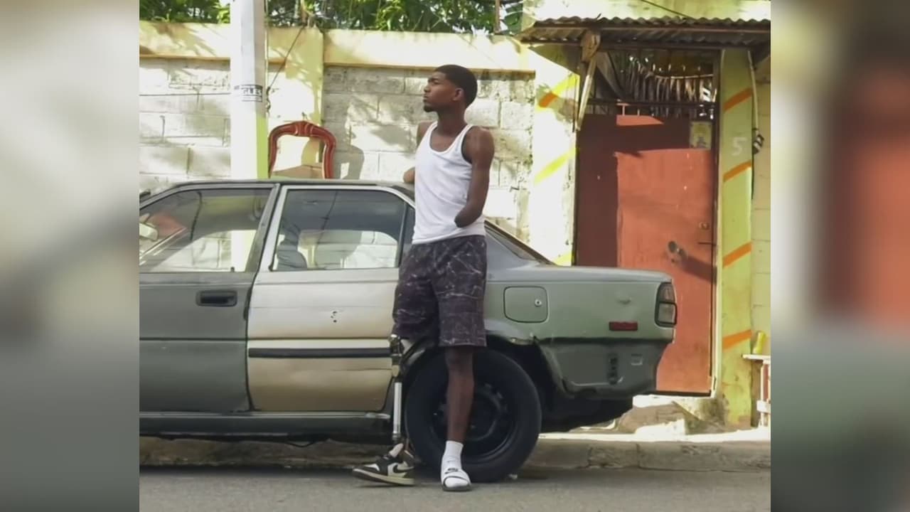 Un joven sobrevivió a un accidente con un cable de alta tensión que lo dejó sin brazos y sin una pierna; ahora busca ayuda para continuar con su vida