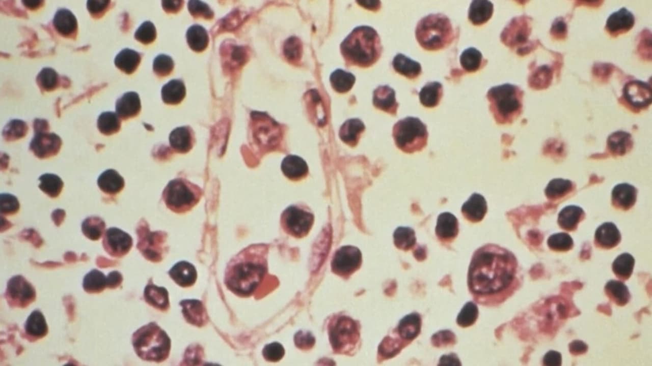 Todo lo que debes saber sobre el hantavirus: cómo se transmite, síntomas y más