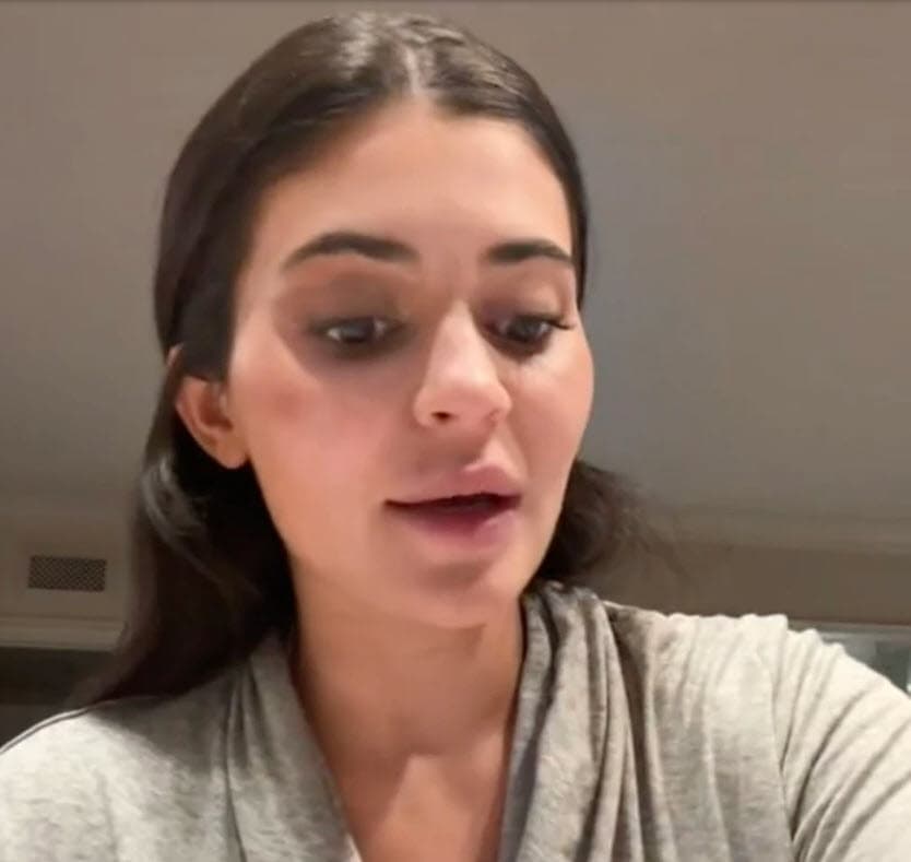 En octubre de 2016, la empresaria admitió que sus labios pequeños la habían hecho sentir 
<b>"como si nadie quisiera besarme".</b>
<br>