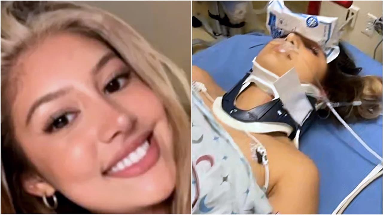 Enfrenta un “dolor insoportable”: Latina sufre múltiples fracturas tras choque que involucró a conductor alcoholizado