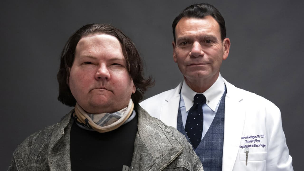 "Estoy muy orgulloso de mi equipo. Todos trabajaron duro", dijo el médico cirujano Eduardo Rodríguez, quien le realizó el trasplante de cara y manos a Joe DiMeo.