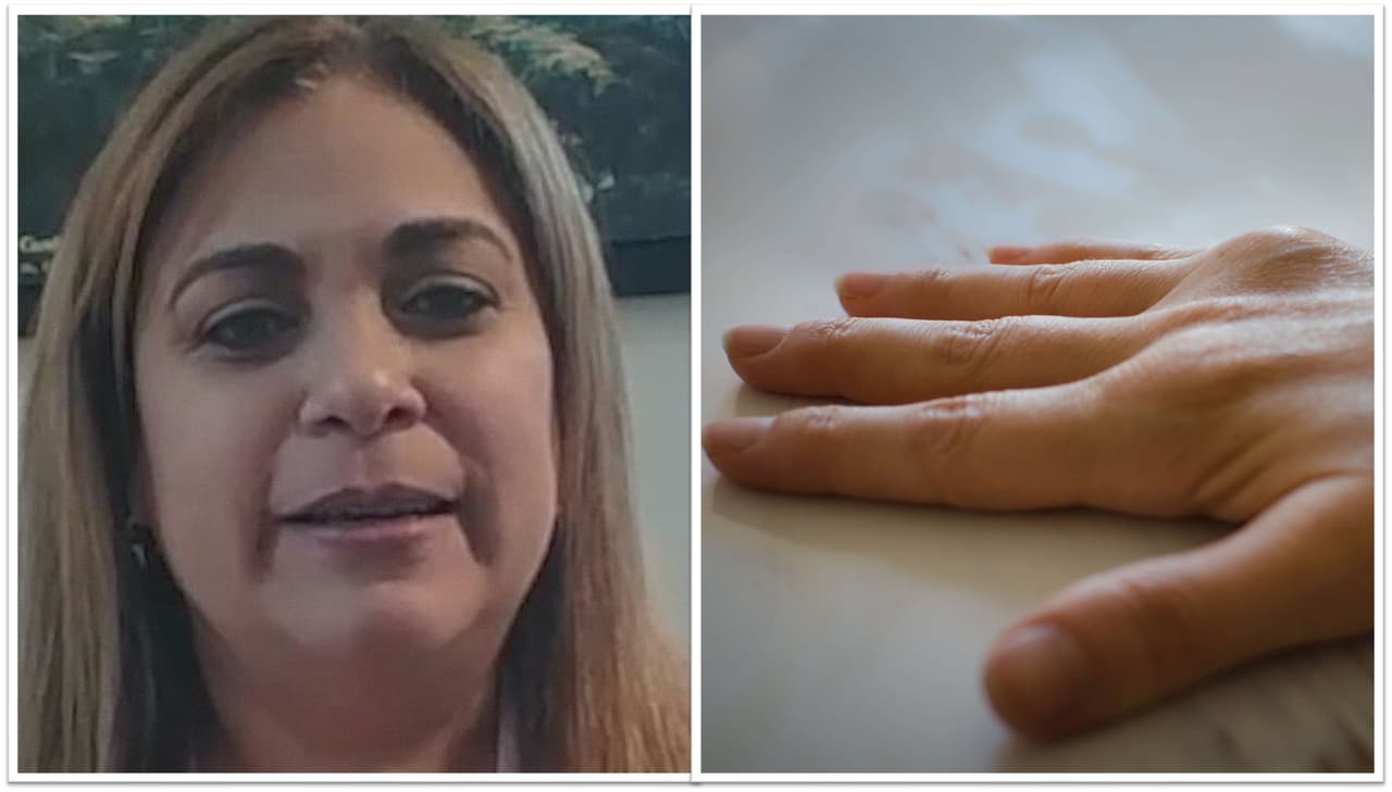 Empezó con un dolor de muñeca, luego de ver tres médicos fue diagnosticada con artritis