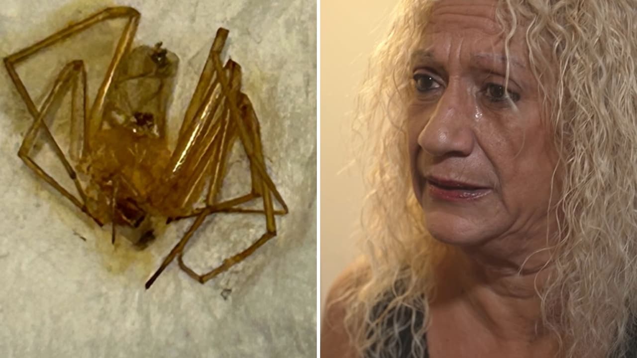Mujer pierde dos dedos por picaduras de araña y demanda a su condominio