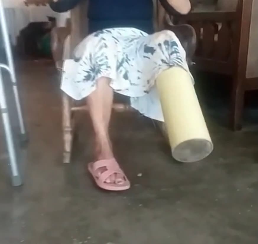 Sin embargo, fiel a su forma de ser y mientras su 
<a href="https://www.univision.com/temas/familia">familia</a> sucumbía ante la tristeza, Ruth miró de frente al doctor y sin titubear le dijo 
<b>“Móchemelo. Si con eso estoy bien, móchemelo y que Dios me dé fuerzas para seguir adelante”. </b>
<br>