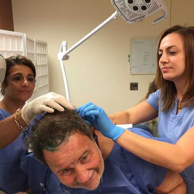 Raúl de Molina quiere tener una cabellera abundante