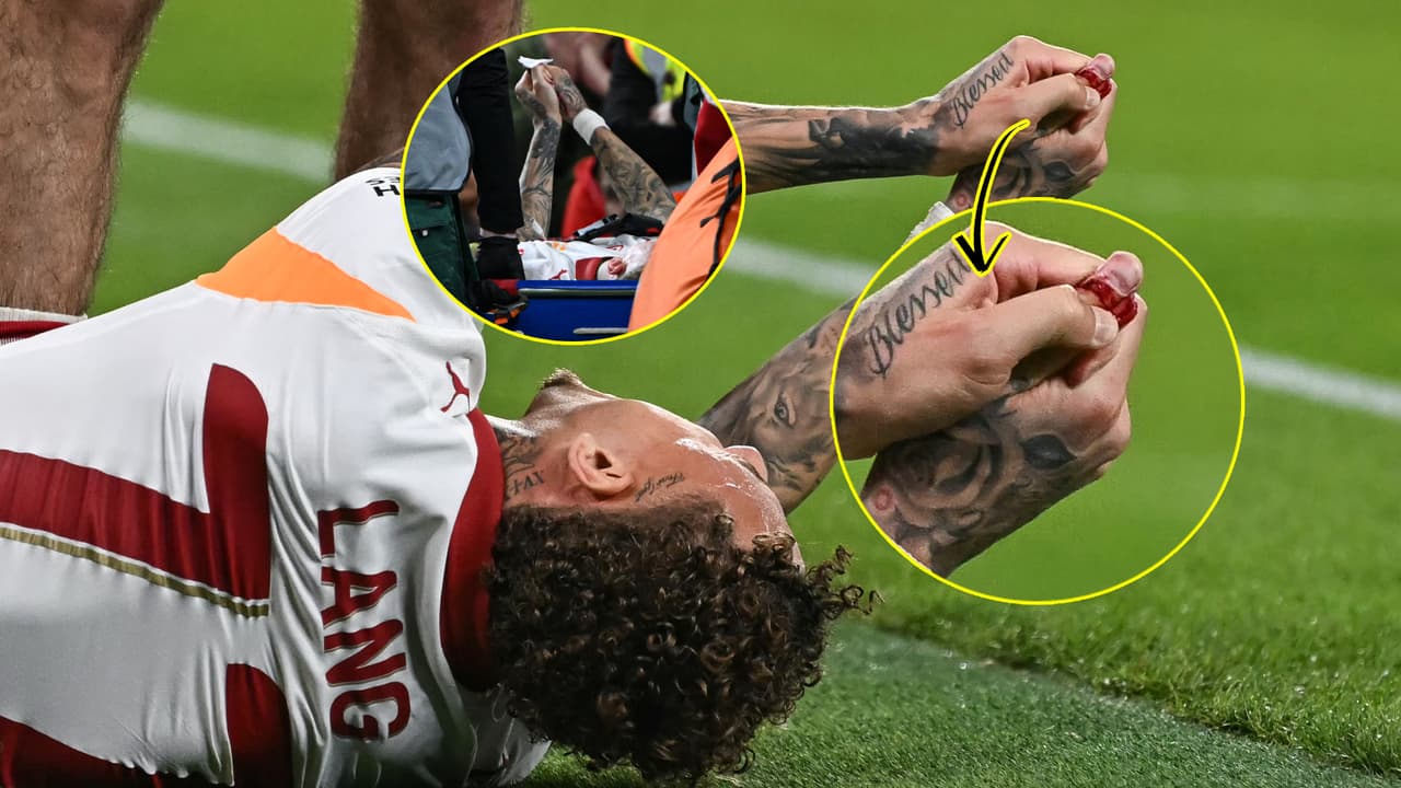 ¡Noa Lang sufre grave lesión en dedo de la mano!