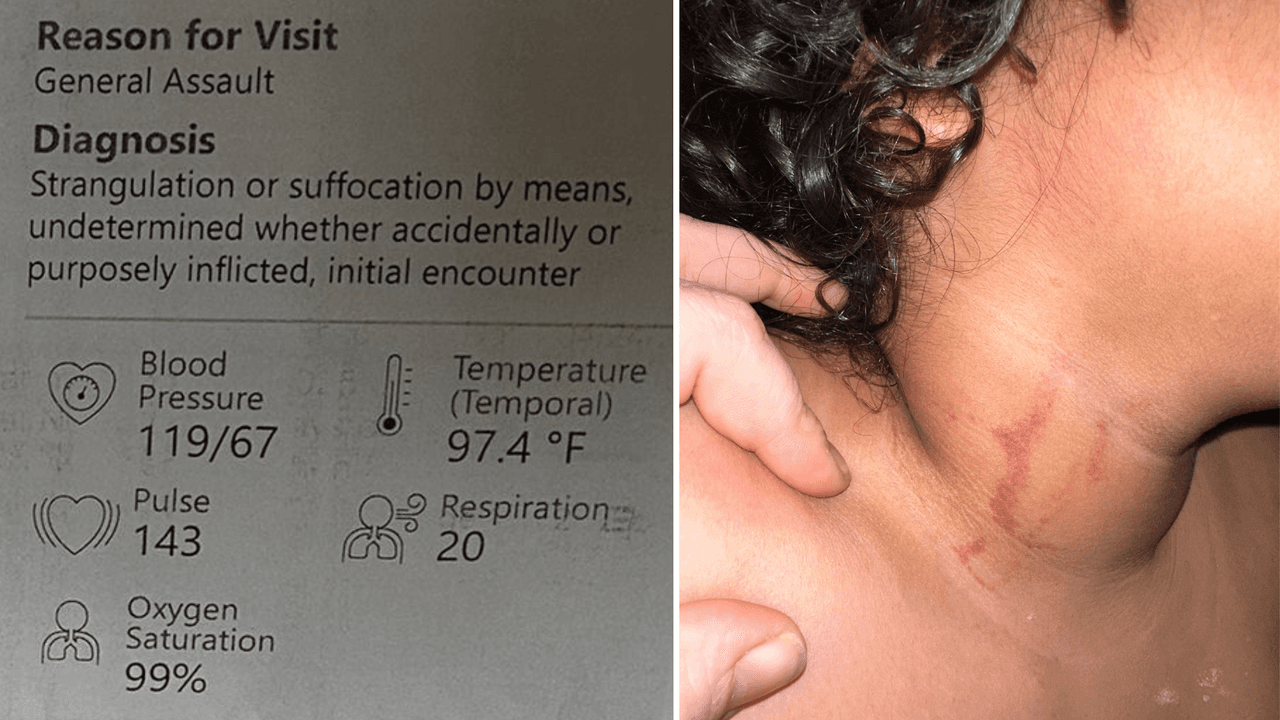 El padre compartió la foto del niño con marcas en su cuello.