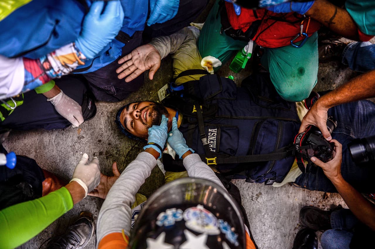 Un periodista herido es atendido por médicos voluntarios en un enfrentamiento en Caracas. Un hombre de 49 años sería el cuarto fallecido durante la huelga, en Naguanagua, en el estado venezolano Carabobo (norte), en otra manifestación opositora.