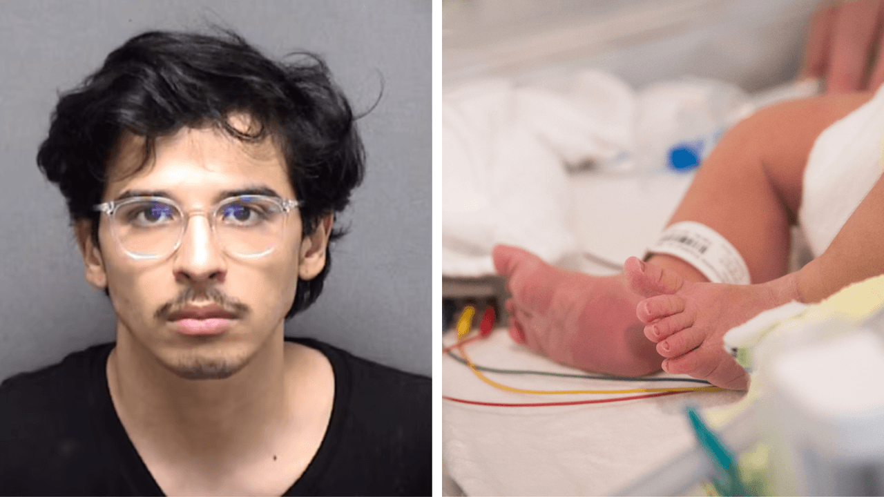 Un padre es sospechoso de provocar un hematoma cerebral a su bebé. ¿Qué es el síndrome del bebé sacudido?