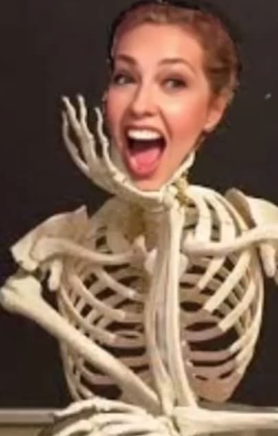 En la década de los noventa se corrió el chisme de que la cantante mexicana se había quitado dos costillas para tener una cintura más marcada.