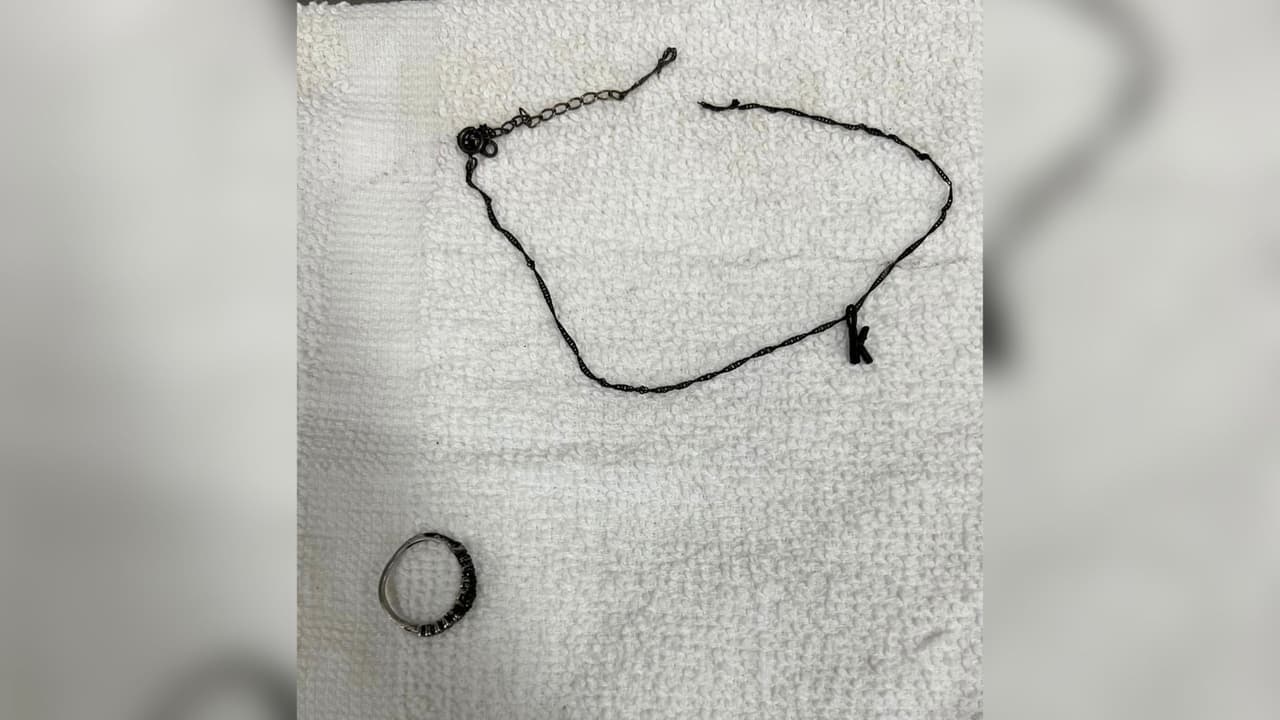 Las autoridades consideran que la mujer era de raza negra y se cree que era menor de 30 años. Cuando las autoridades la hallaron, su cuerpo estaba envuelto en llamas y posteriormente se confirmó su muerte en el lugar.
<br>