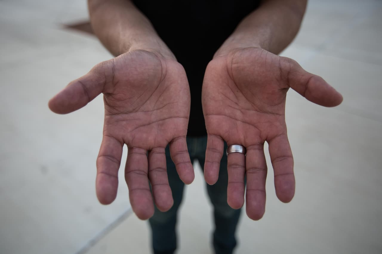 Juan Carlos, 25, de México, trabaja el maíz y el frijol. Intenta usar guantes para cuidarse las manos. “Quieren nuestro trabajo, pero no nos quieren a nosotros”, afirma.
