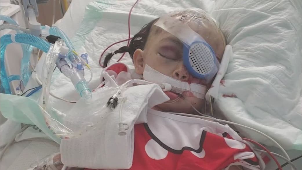 ¿Un accidente? El padre de una niña de 2 años herida de bala en la cabeza pone en duda la versión oficial