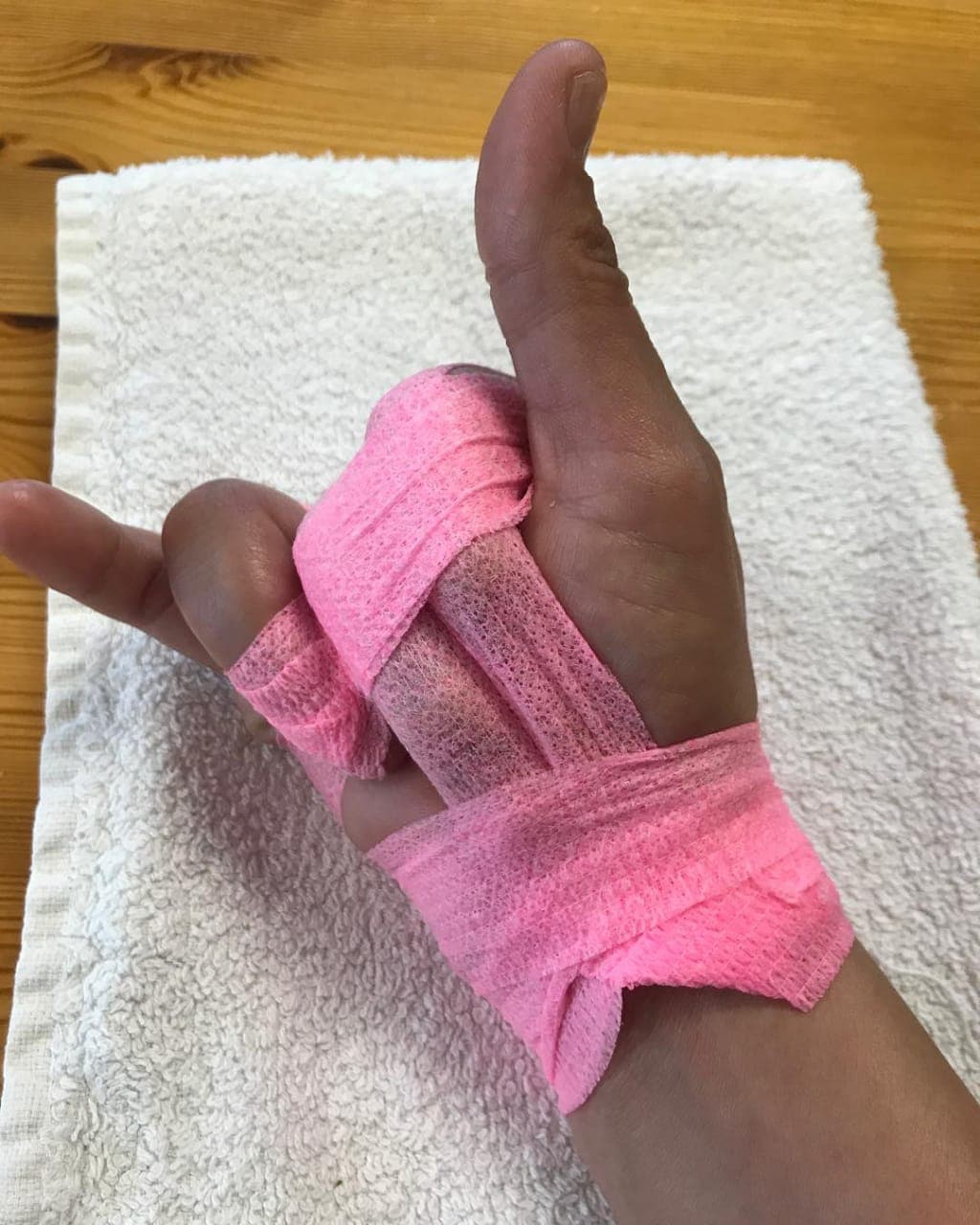 Ahora Shaila está enfocada en su salud, principalmente, en la 
<a href="https://www.univision.com/famosos/shaila-durcal-ya-no-se-preocupa-por-haber-perdido-parte-de-un-dedo-y-lo-demuestra-con-esta-fotografia-fotos" target="_blank">rehabilitación de su mano</a> luego de que en agosto de 2018 perdiera una parte del dedo índice derecho.