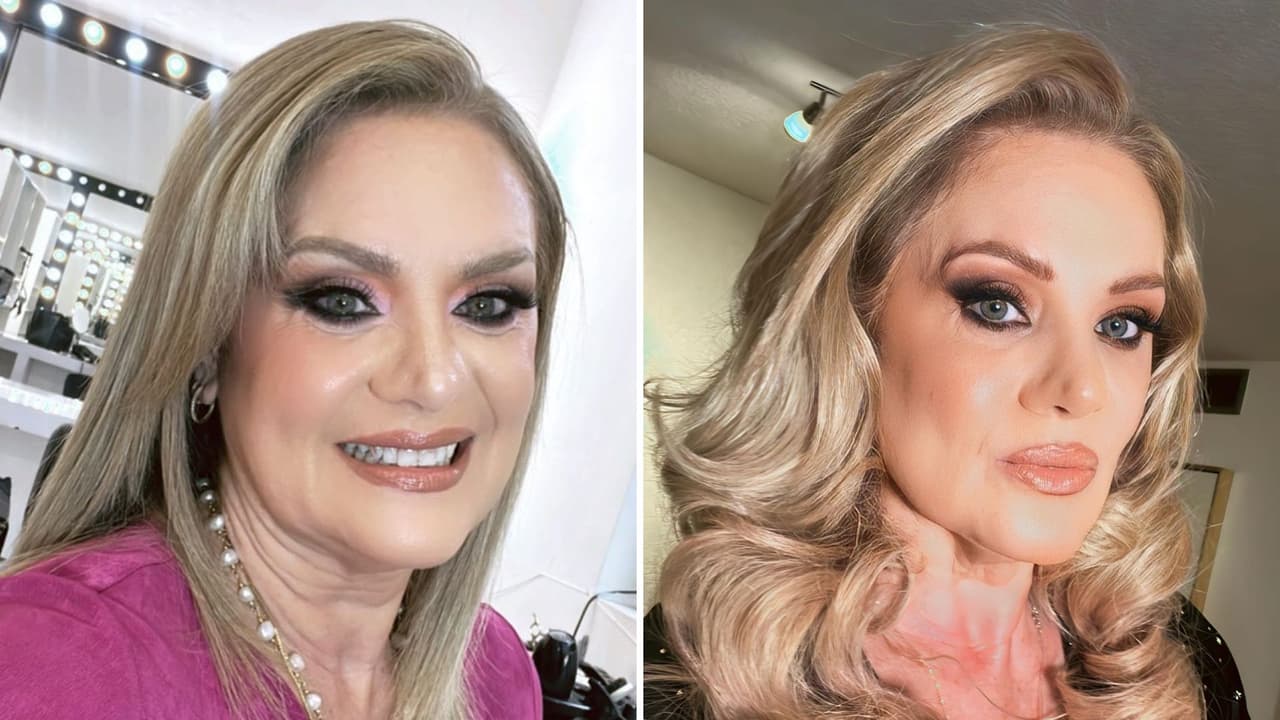 Erika Buenfil se hace procedimiento estético en el rostro: así lo modificó