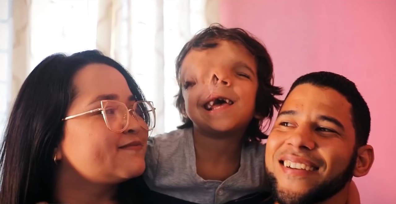 <br>Para ayudar a Lucas se puede comunicar directamente al número telefónico en Venezuela 011 58-4246-611-588 o ingresar a la cuenta de 
<a href="https://www.gofundme.com/f/asmile4lucas" target="_blank">GoFundMe</a> abierta para auxiliar al niño. 
<br>