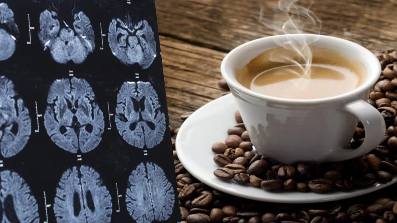 Reducción del cerebro y demencia: Alertan sobre el consumo excesivo de café