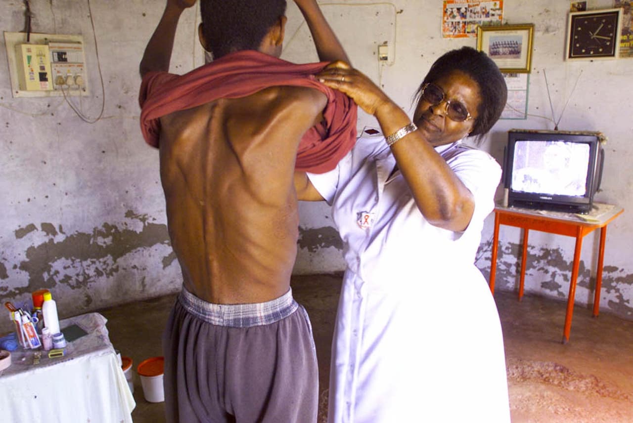 <b>Epidemia de VIH/sida (1960-presente).</b> Este virus ataca el sistema inmune y lo debilita para que el cuerpo ya no pueda combatir infecciones. Ha matado a más de 39 millones de personas desde la década de 1960 y debido a que afectó primero a la comunidad gay, incentivó el estigma y la discriminación. El desarrollo de medicamentos antirretrovirales permite que las personas afectadas por la enfermedad sobrevivan. Las infecciones anuales por VIH disminuyeron en un 8% en EEUU y en un 18% a nivel mundial de 2010 a 2015. En África (en la fotografía) se registran el 70% de los casos de esta enfermedad.
<br>