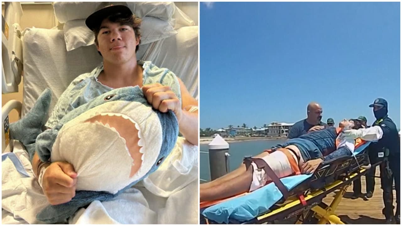 "Me mordió dos veces": Joven hispano de 20 años sobrevive al ataque de tiburón en Florida