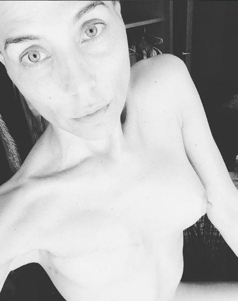 Lorena Meritano ha compartido en redes sociales el largo y tortuoso camino que ha tenido que recorrer desde que le diagnosticaron cáncer, en 2014.