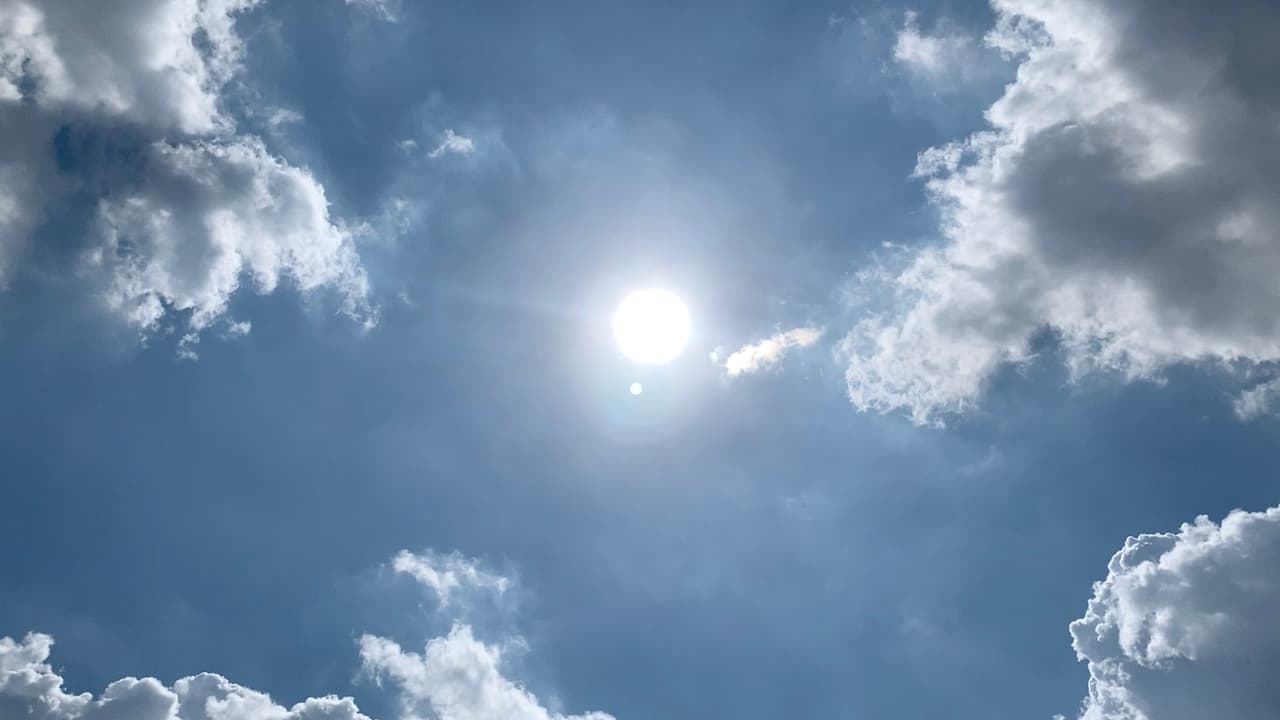 En caso de presentar quemaduras de este tipo, el Dr. Varón aconseja acudir con su profesional de la salud para que evalúe las lesiones.