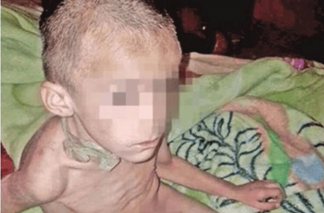 Aspecto con el que fue encontrado Antony por las autoridades.