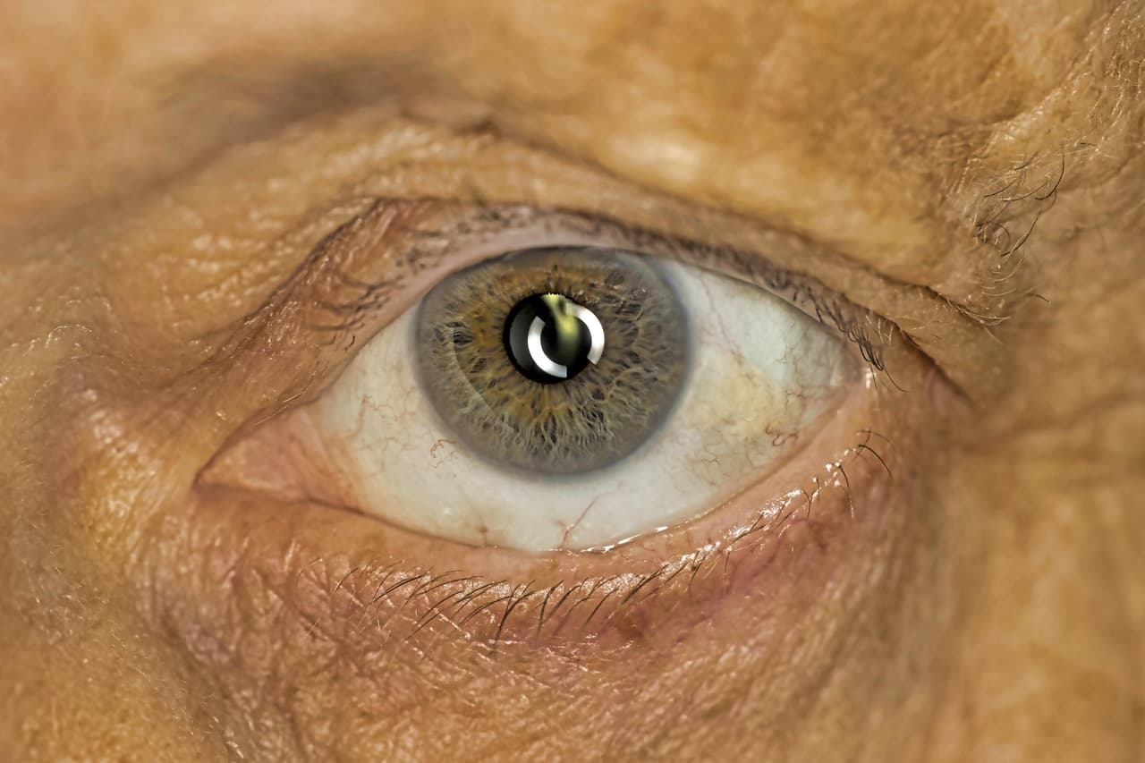 El iris con un espacio en blanco por debajo es un mal augurio según la teoría Sanpuku