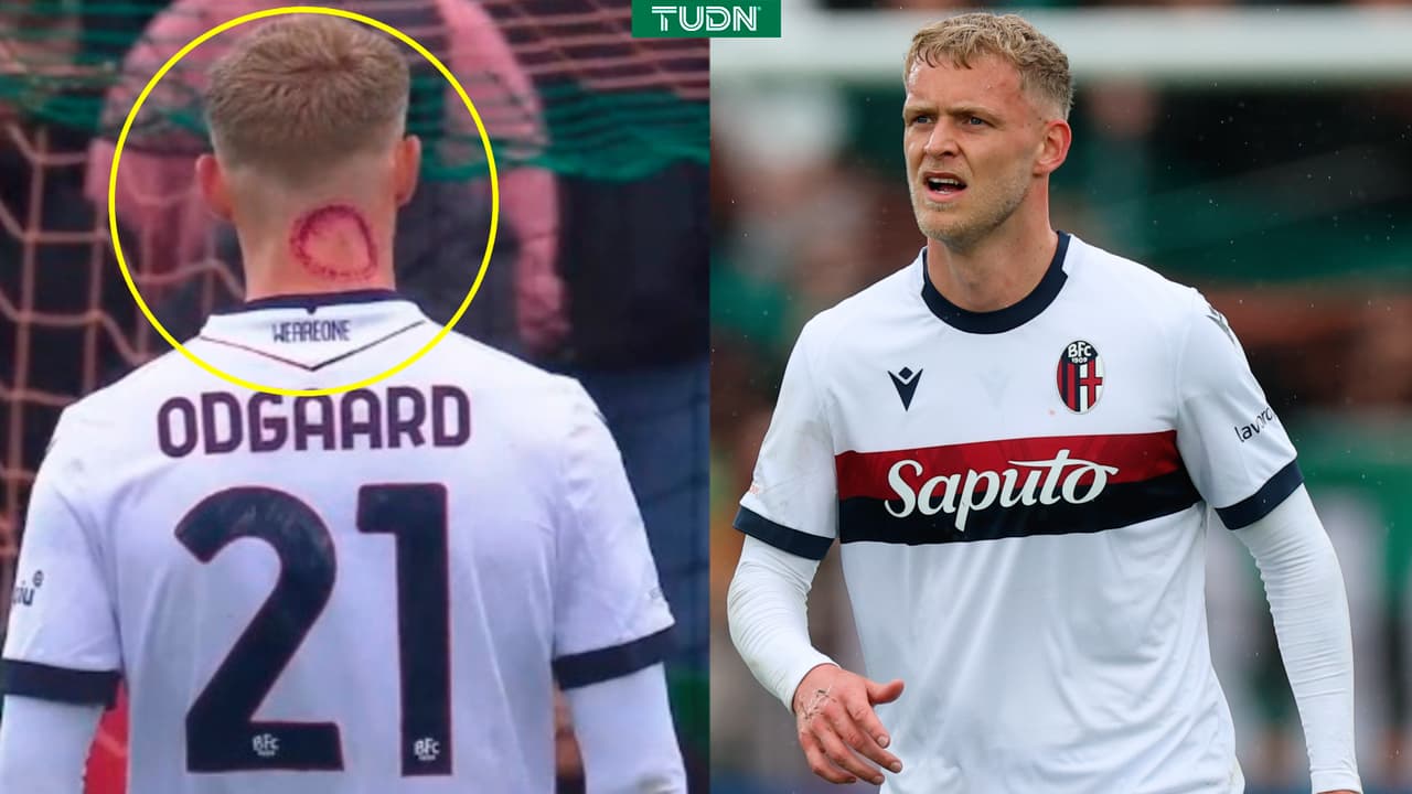 Jugador niega mordida de zombie y aclara extraña marca en su cuello