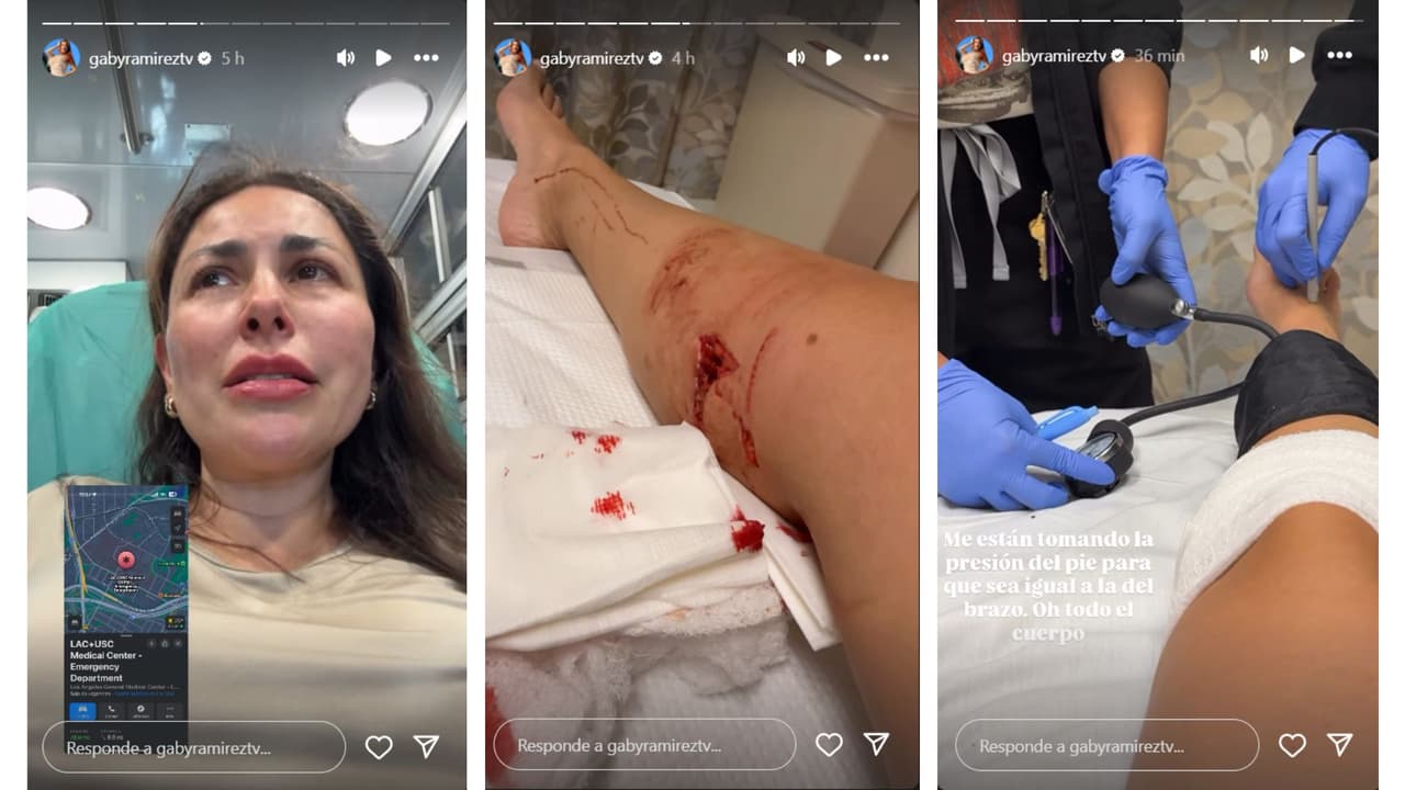 La presentadora tuvo que ser hospitalizada tras ser mordida por un perro.