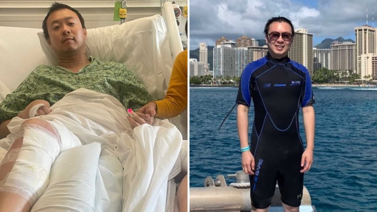 Pierde un dedo víctima de tiroteo en Lake Merrit durante celebración del Juneteenth