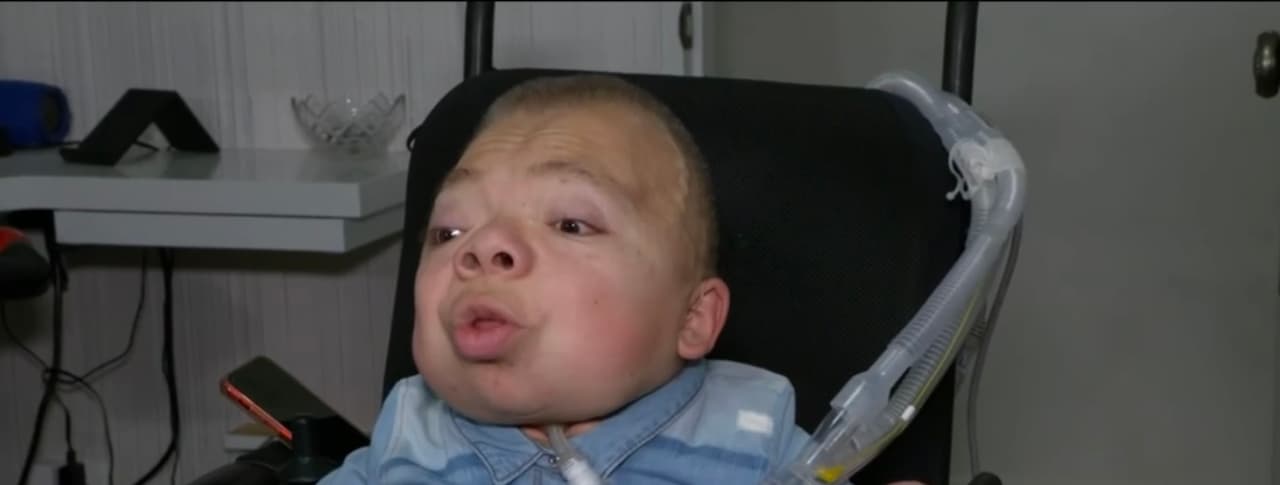 Christopher Álvarez es un joven de 23 años que padece enanismo tanatofórico, una rara enfermedad que afecta el desarrollo del esqueleto y en el cual crecen los órganos pero no la caja toráxica.
<br>