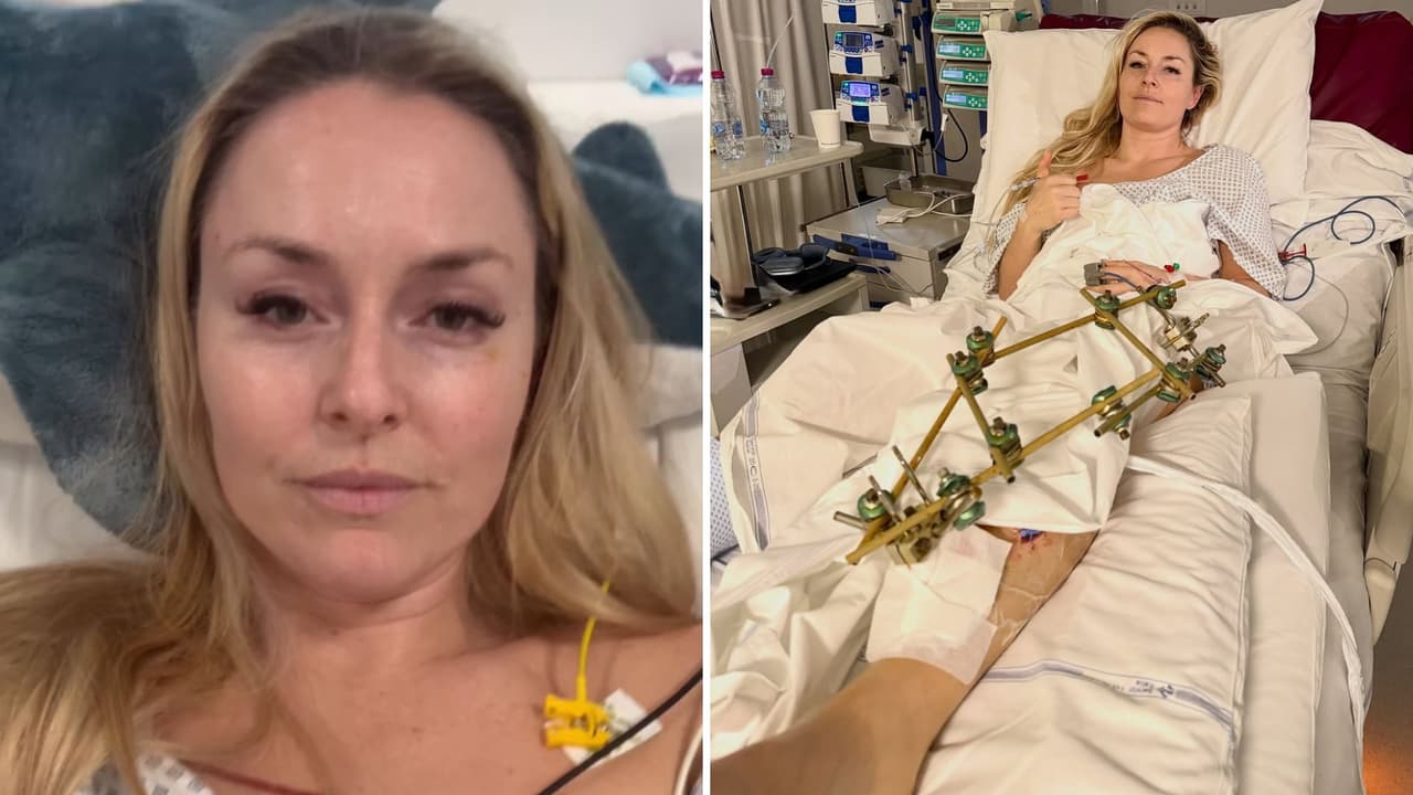  Juegos Olímpicos de Invierno: famosa atleta sufre dolorosa pérdida tras sufrir accidente