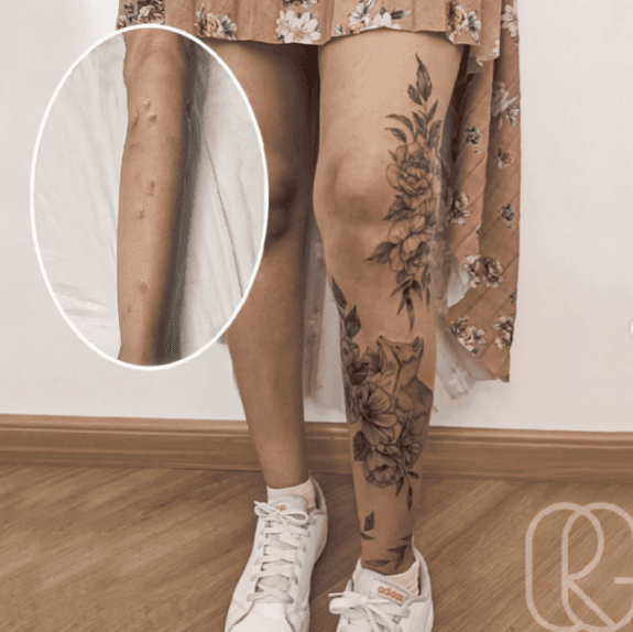 La preparación e ideas del tatuaje es una de las partes más importantes para hacer arte: 
<br>
<br>“Cuando la clienta nos da la libertad de desarrollar su tatuaje sobre la cicatriz, somos libres de hacerlo de la mejor manera posible”, dice Gauthier en Instagram.